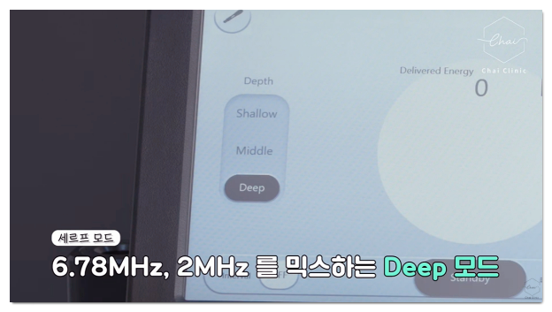 세르프 레이저 장비의 모드 조 화면