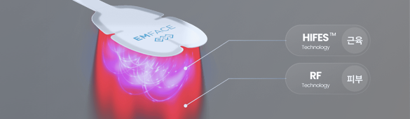 차이의원 엠페이스